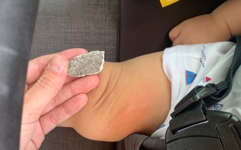 Bimbo di sette mesi ferito da calcinaccio caduto da un palazzo